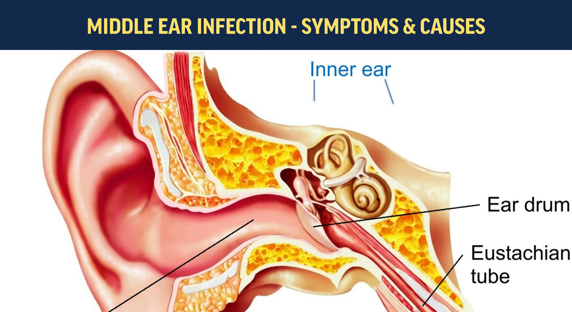 Ear infection top