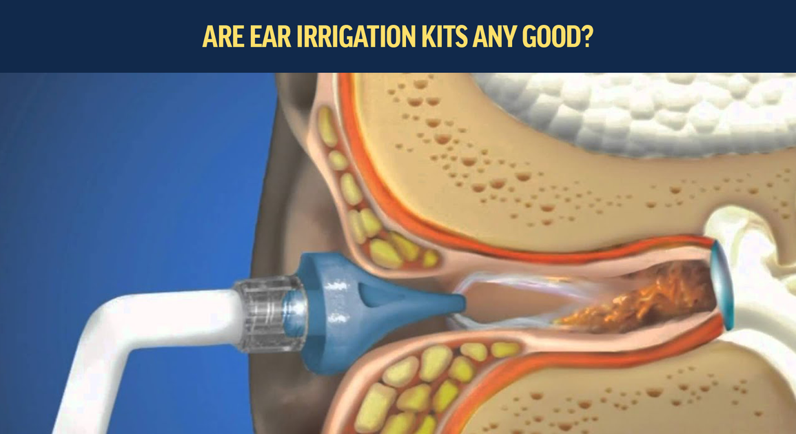 Are Ear irrigation kits any Good? Axel Glade