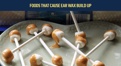 Top foods that cause ear wax