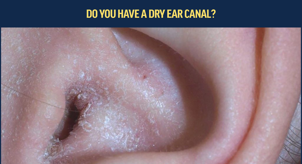 Dry Skin in Ears: Causes and Treatment