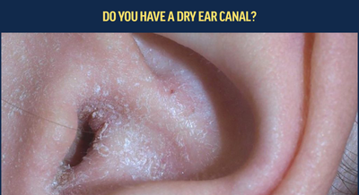 Do you have a dry ear canal?
