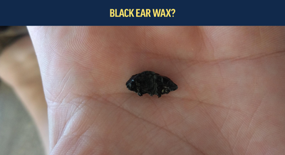 What is black ear wax?