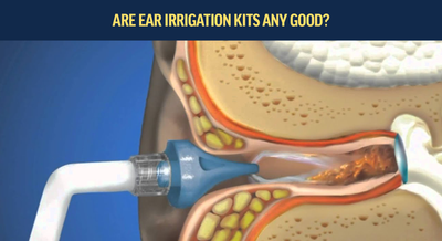 Are Ear irrigation kits any Good?