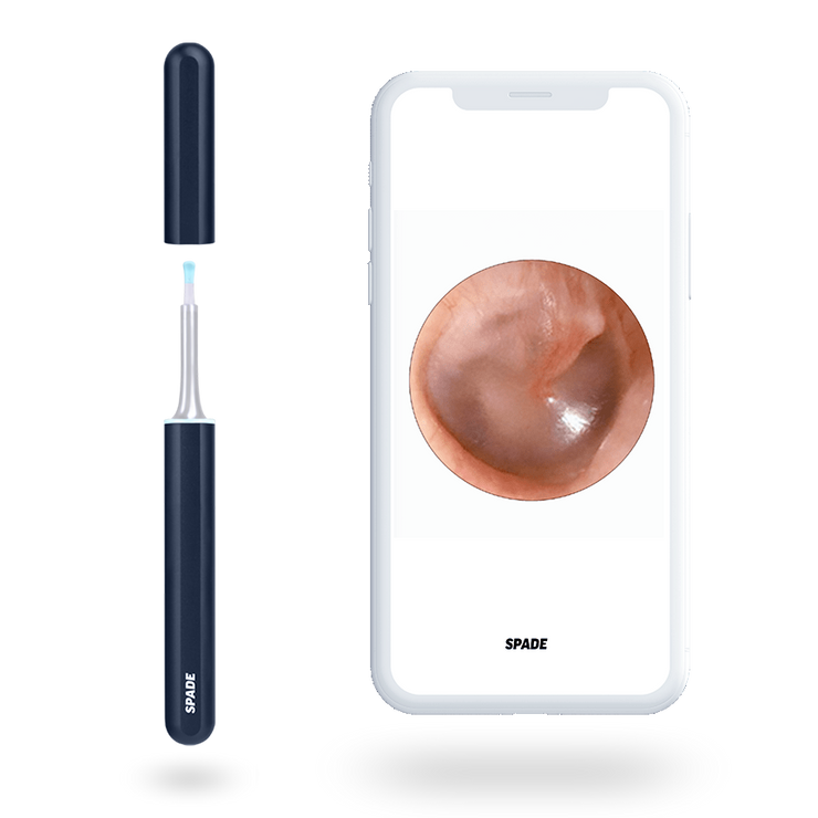 Spade - The Smartest Ear Cleaning Kit-by Axel Glade-Axel Glade